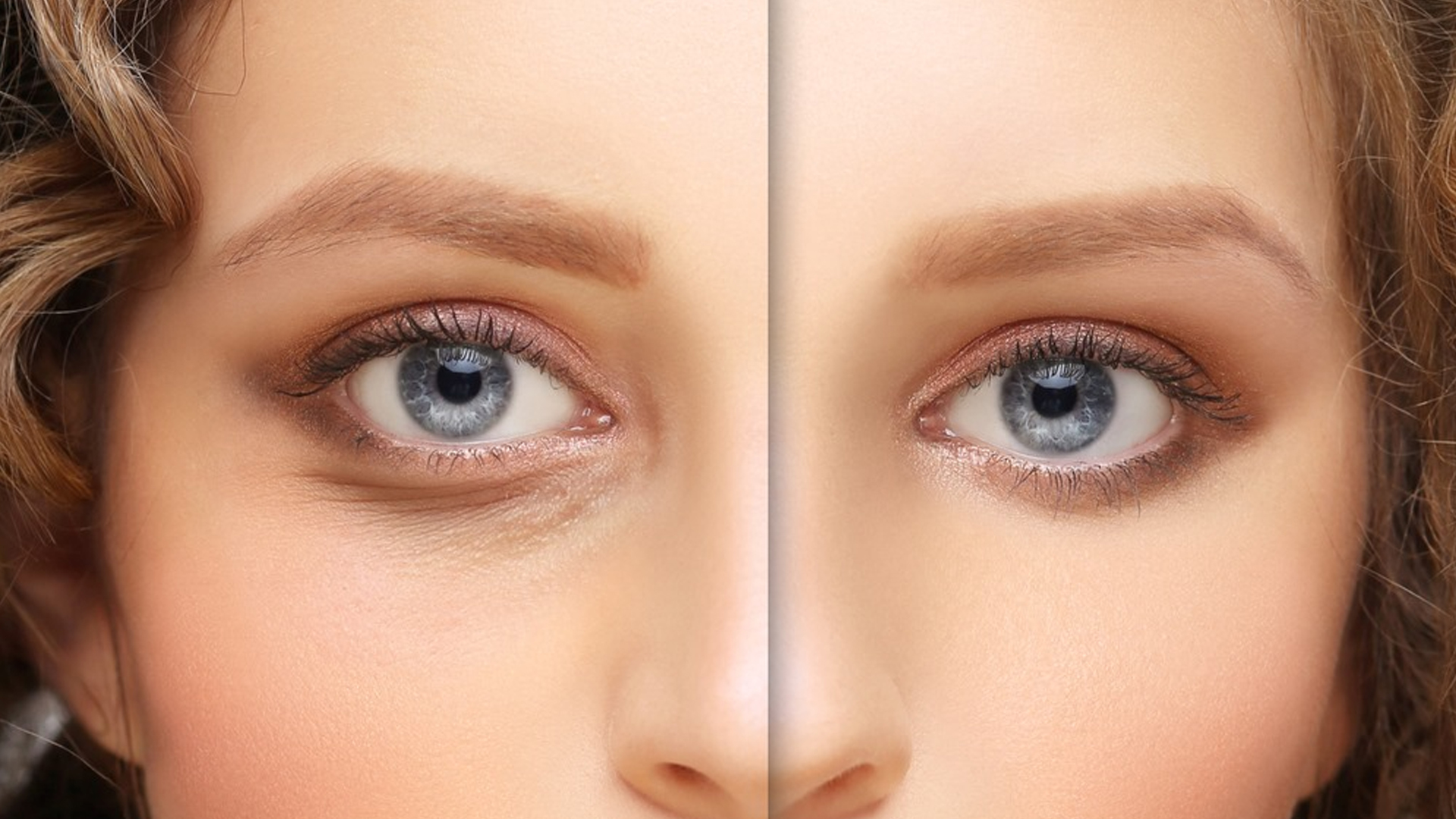 oculoplasty in mulund